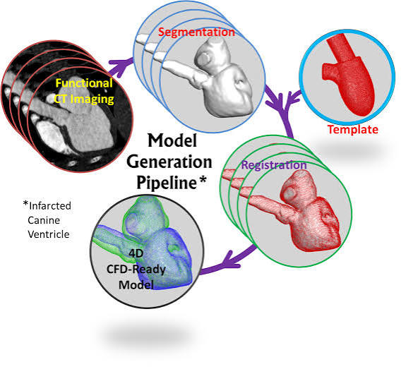 Model generation pipeline: functional CT imaging, segmentation, registration against a template, producing a 4D CFD-ready model of an infarcted ventricle